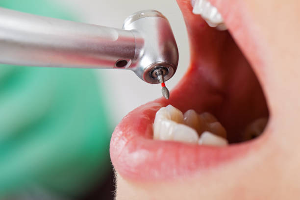Best Broken or Chipped Tooth Repair in Tarentum, PA